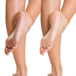 Máscara Esfoliante para Pés