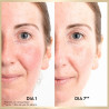 Anew Renewal Power Sérum Renovador - RECARGA