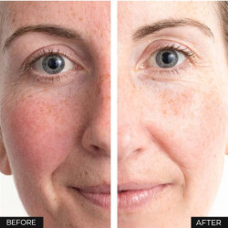 Anew Renewal Power Sérum Renovador - RECARGA